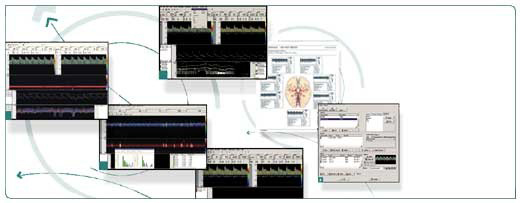 Aparelho doppler transcraniano