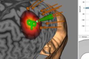 Neuro-Imagem – NIRS Neuro-Imagem – NIRS