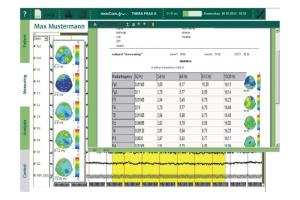 Thera Prax® QEEG Thera Prax® QEEG